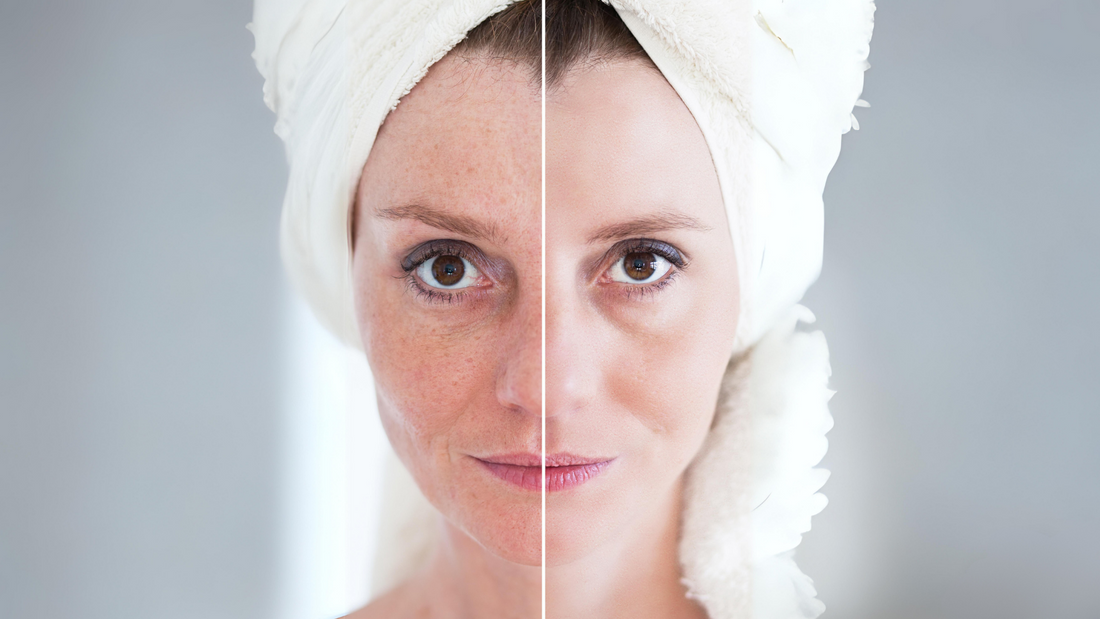 Turning Back the Clock — Effective Anti-Aging Skincare Strategies